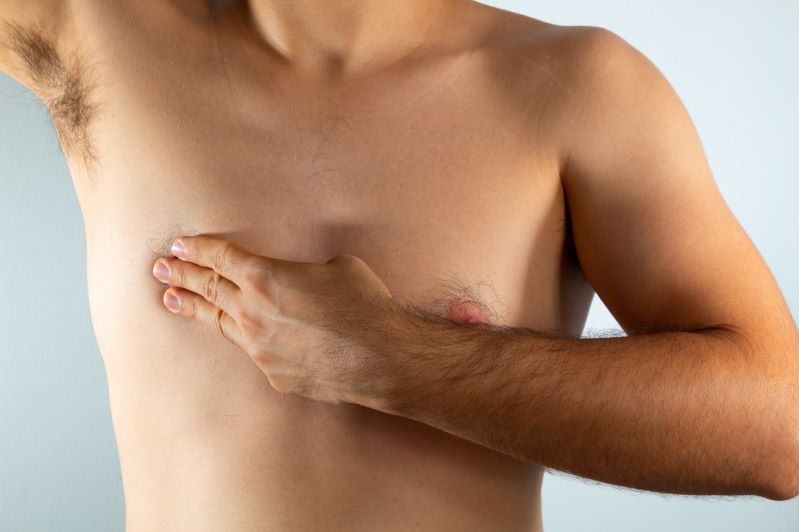 Cáncer de mama en hombres también es un riesgo latente. Los síntomas en hombres son similares a los observados en mujeres, por lo que es igual de importante que hombres y mujeres se revisen periódicamente